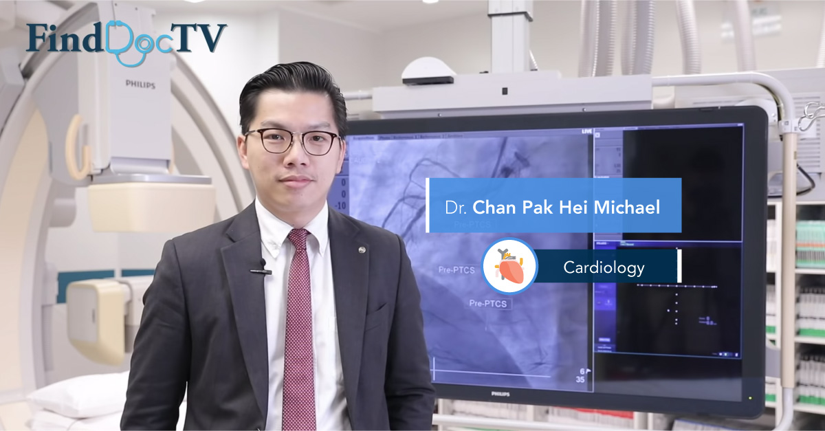 Angioplasty Angioplasty
